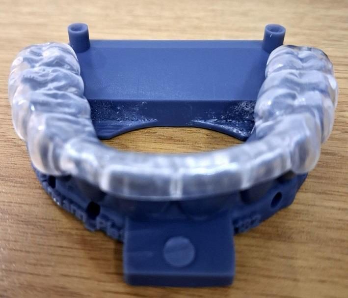 Milled bite splint on model