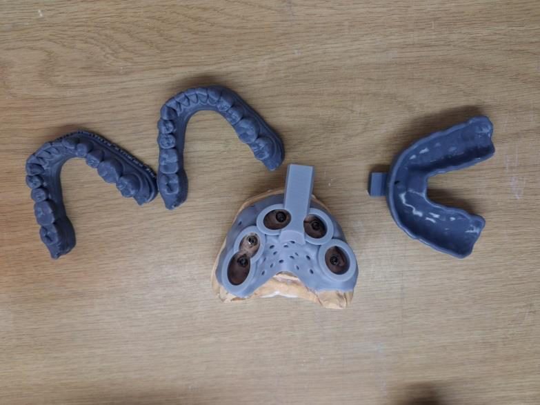 3D-printed appliances and special tray